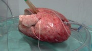Eighty percent of donated lungs can’t be used for transplants because of injury or other problems. Researchers at the Cleveland Clinic are using an experimental process to help revive those lungs that would otherwise be deemed unusable