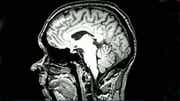 What potential does new study present?
