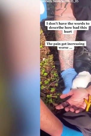 SEE IT: Hawk PINS woman with talons (GRAPHIC)