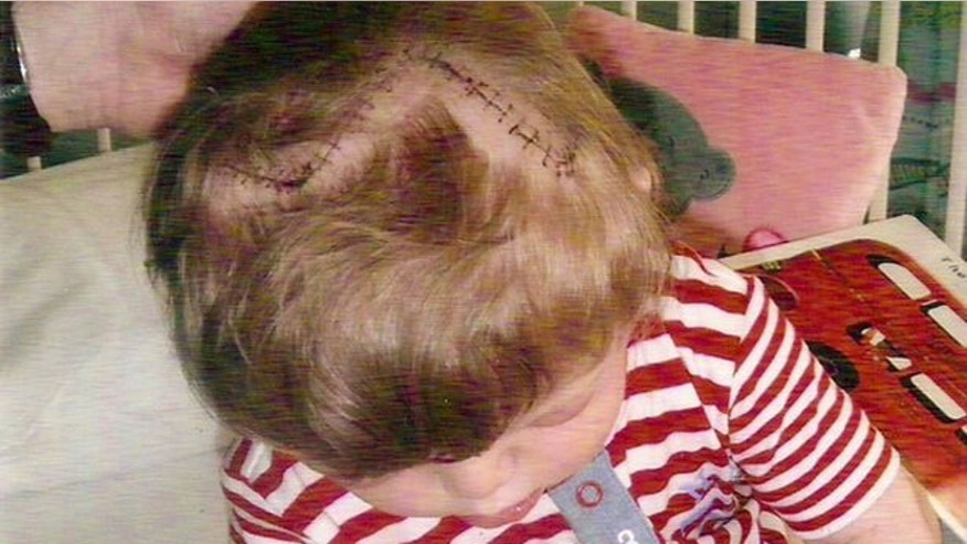 SophieAfterSurgery