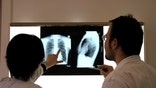 Requirements included in health-care reform have many doctors considering exiting the system earlier, but what will that mean for patient care?
