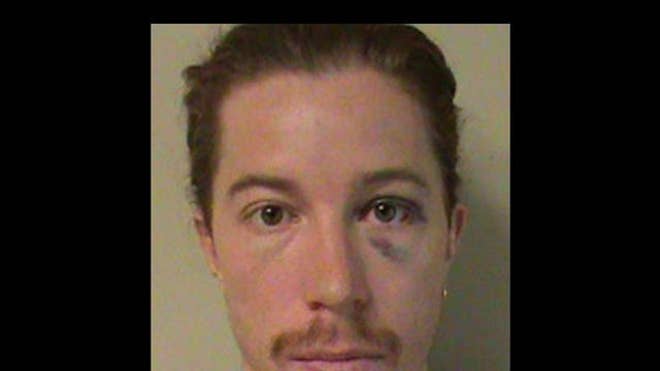 shaunwhite.jpg