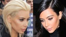 Celebs with restless hair syndrome.