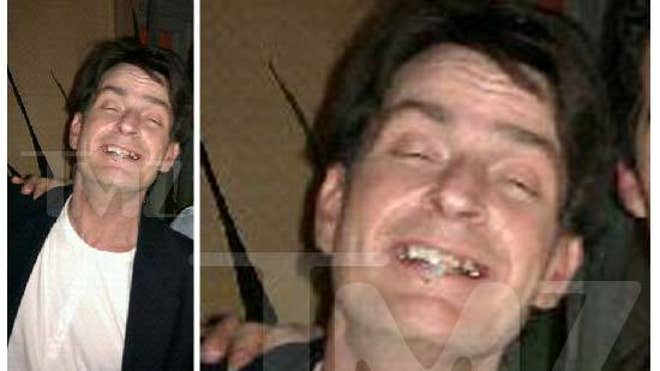 charlie teeth tmz restrix