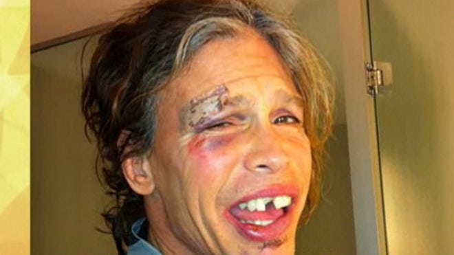 steven tyler face tooth