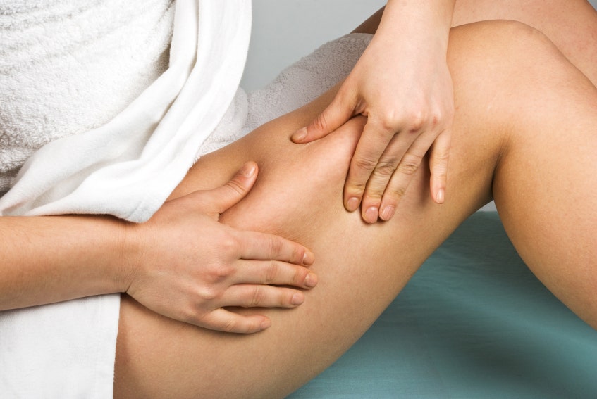 Laser treatment best option for varicose veins