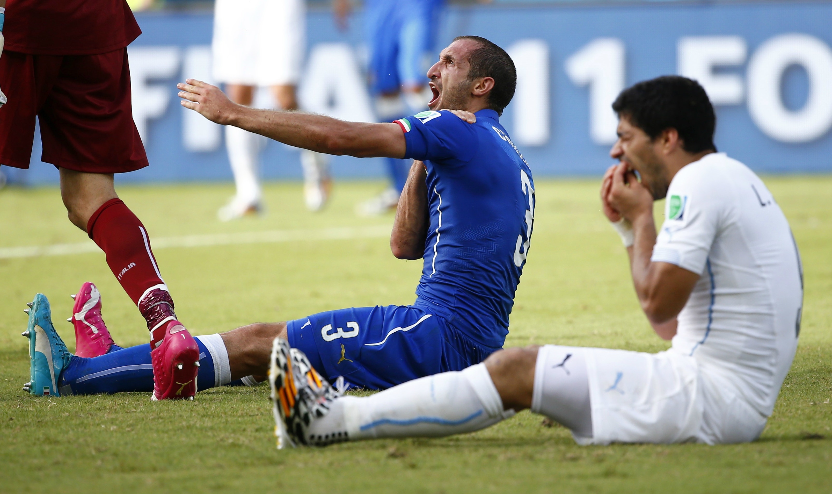 Dr. Manny Soccer player's bite during World Cup game is very dangerous