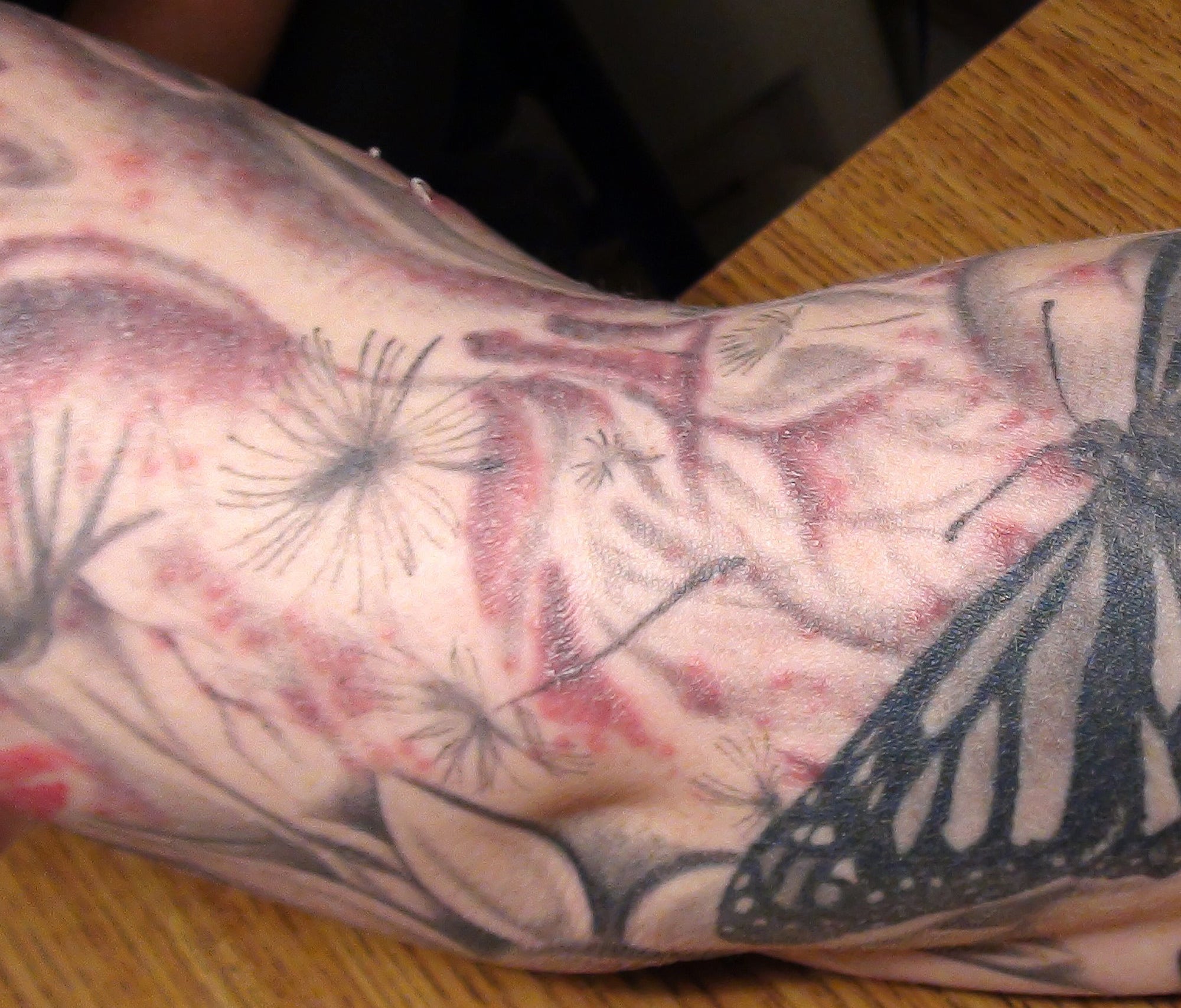 Tattoo infections linked to manufacturers' ink Fox News