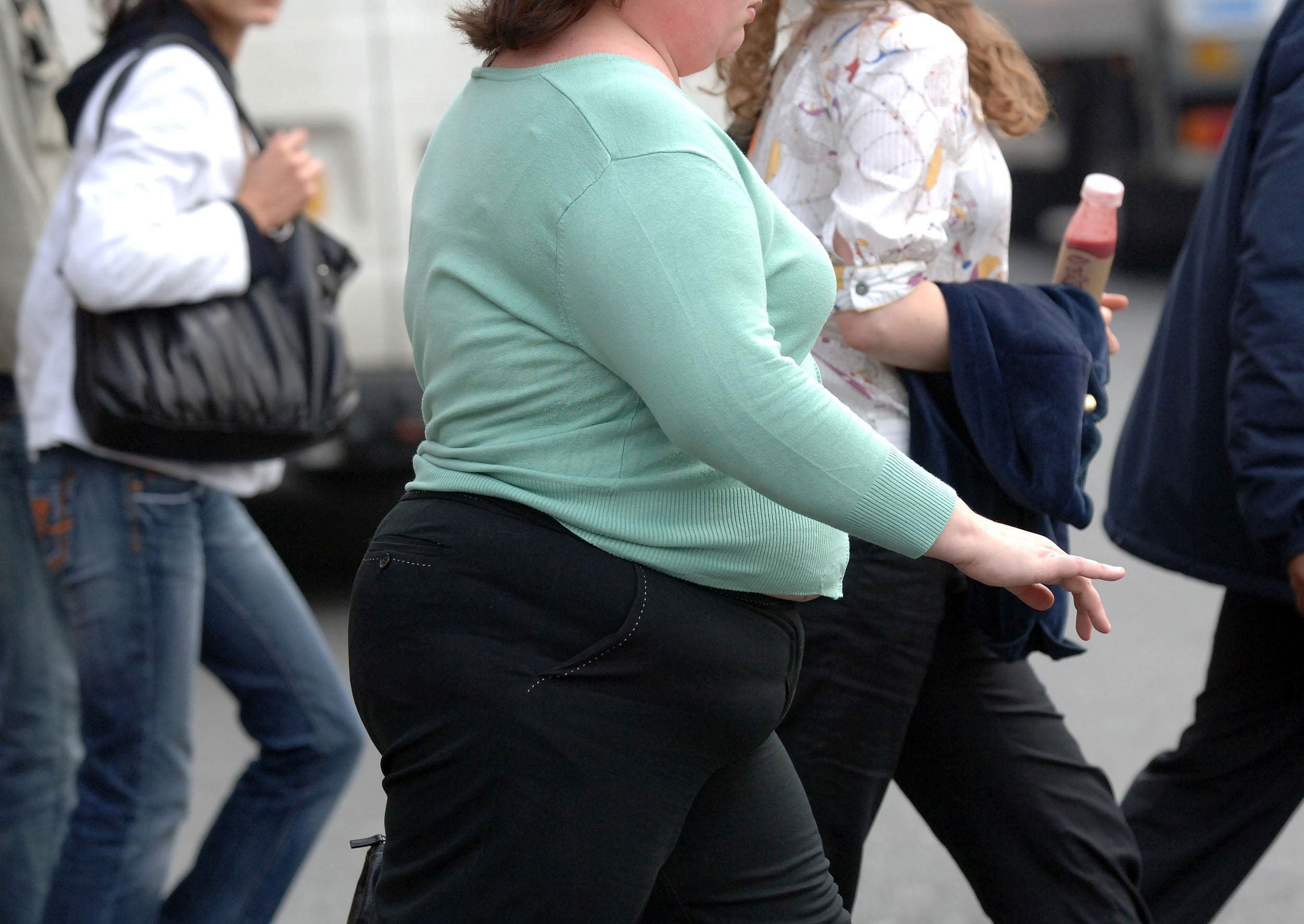 Obese Woman