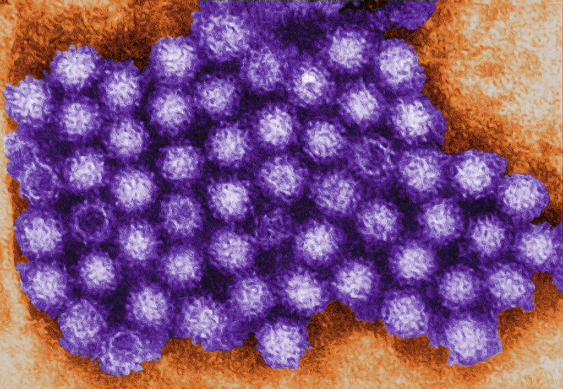 Norovirus1.jpg