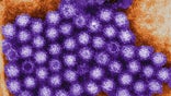 A new strain of norovirus — a stomach bug that causes diarrhea and vomiting — was responsible for most outbreaks of the disease in the U.S. in recent months, the Centers for Disease Control and Prevention said Thursday