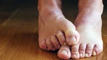 Grandma isn't the only one with bunions. Just  years old, Kacey Barker, of Haverhill, Mass., found herself with a painful joint jutting out from the base of her left big toe