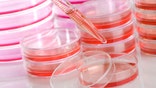 In the first procedure of its kind, skin cells taken from patients suffering from heart failure were “reprogrammed” and changed into heart muscle cells. Not only were the transformed cells healthy, but they were also transplanted into the hearts of rats and were able to integrate with the existing heart tissue