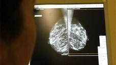 Women in their s didn't cut back on mammograms during , the year after a government-backed panel said annual breast cancer screening should be optional for them, says a new study.