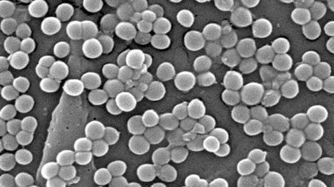 MRSA