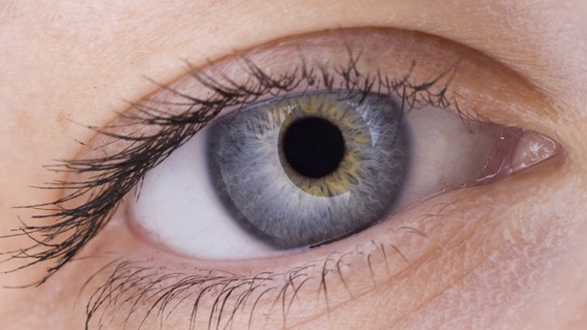 Eye