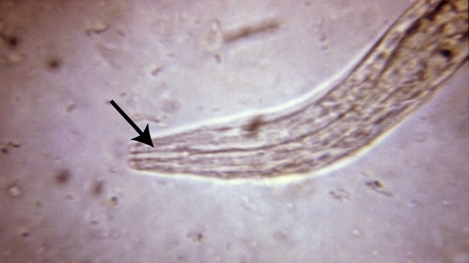 Hookworm