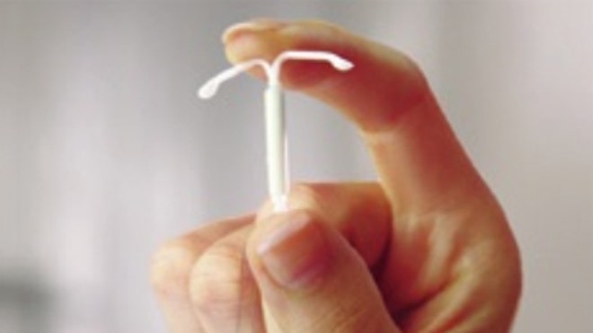 Pictures Of Iud