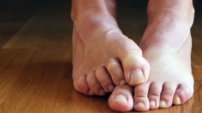 Men Toenails