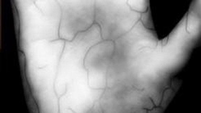 hand_vein.jpg