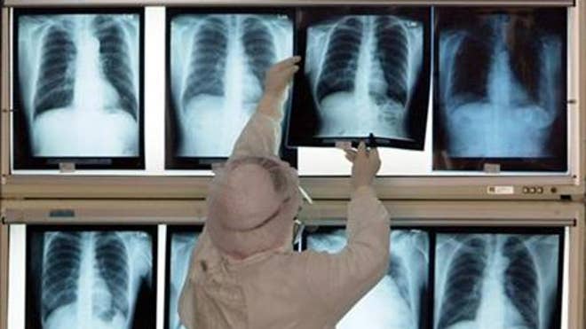 lung.jpg