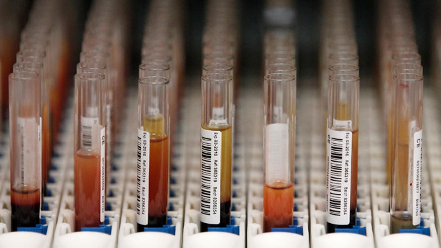 blood test