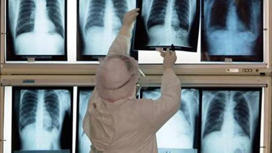 lung.jpg