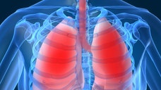 Screening for lung cancer using low-dose computed tomography (CT scans) rather than chest x-rays may be a more effective way of preventing the disease.
