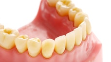 A U.K. woman had dentures stuck in her throat for nine weeks – and doctors couldn’t figure out the cause of her discomfor