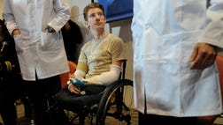 >A Boston hospital is starting the world's first hand transplant program for children, and doctors say it won't be long until face transplants and other radical operations to improve appearance and quality of life are offered to kids, too.