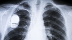 >Although there are no known instances of someone hacking a pacemaker or similar device to harm another person in real life, the danger is real. That's why researchers at Rice University in Houston decided to look for a better way to protect people's IMDs.