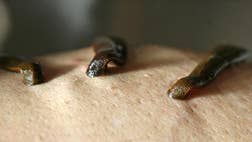 The sickest remedies to cure what ails you