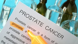 Recently, the American Urological Association (AUA) announced new guidelines for prostate specific antigen (PSA) testing. Here is what you need to know