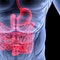 Outbreak of 'nightmare bacteria' in Illinois stirs worry