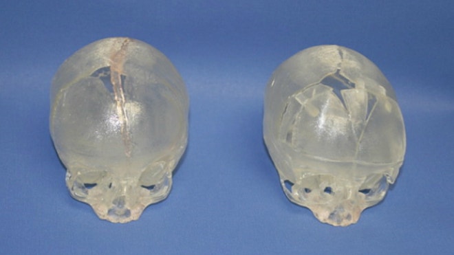 3D Baby Skull 1.jpg