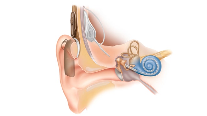 640_CochlearHearing.jpg