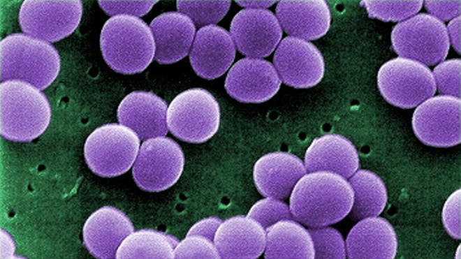 780px-Staphylococcus_aureus_VISA_2.jpg