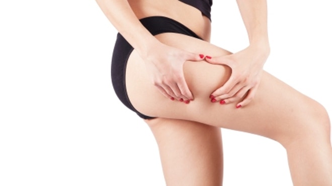 AnotherCellulite.JPG