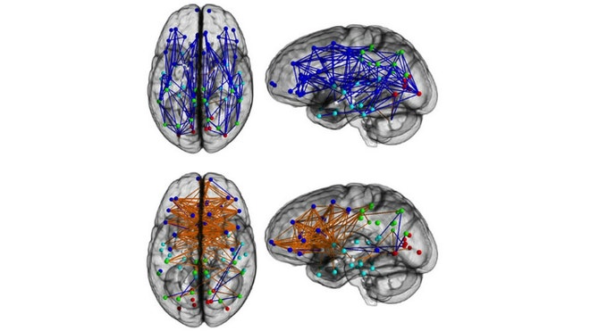 Brain sex differences LiveScience.jpg