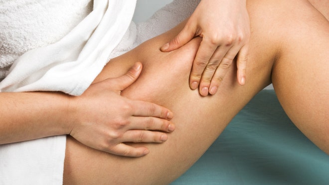 Cellulite.jpg