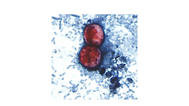Cyclospora.jpg