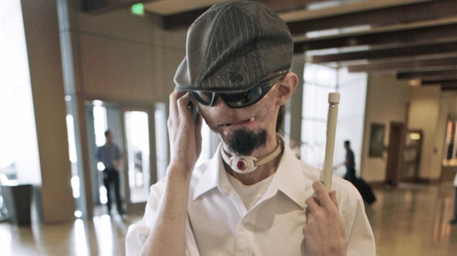 Dallas face transplant 2