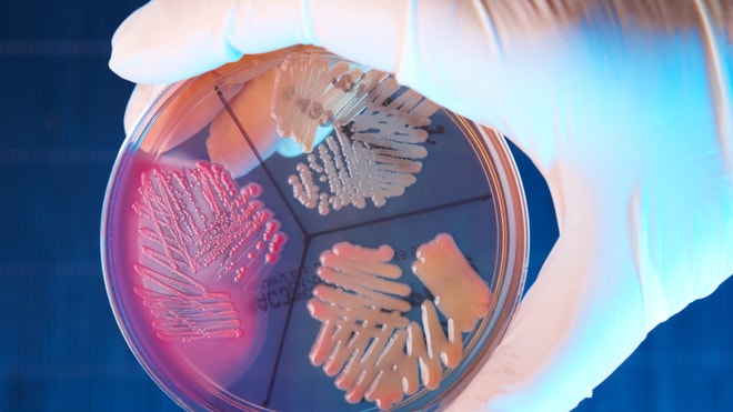 Ecoli petri dish