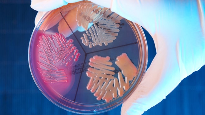 Ecoli_NDM1_640