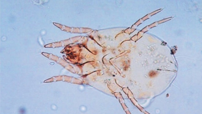 MITES.JPG