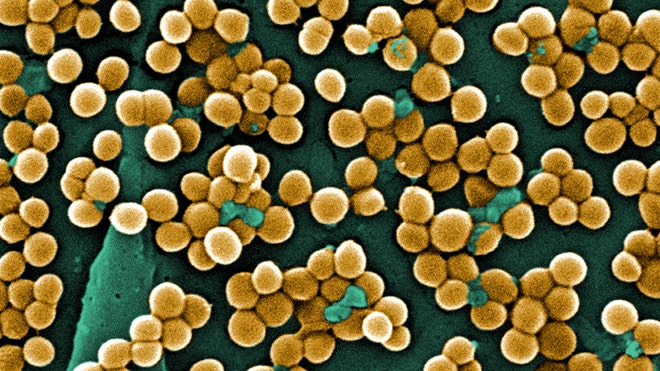 MRSA CDC.jpg