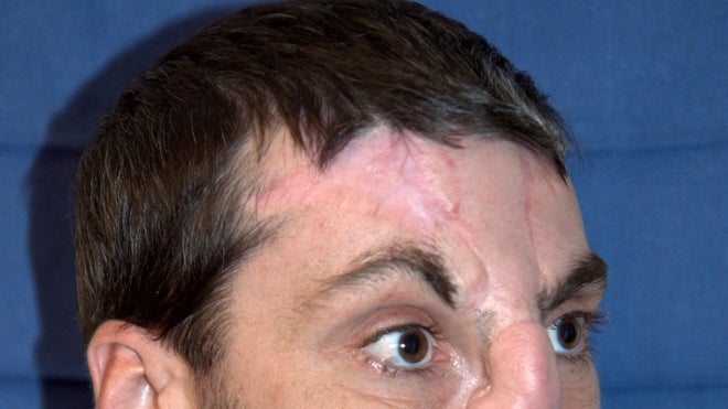 Richard_BeforeSurgery.jpg