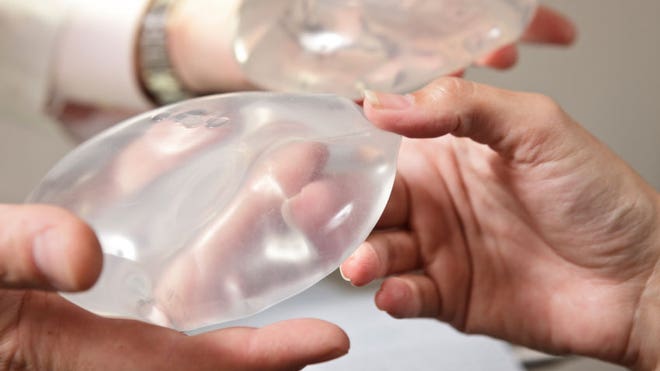 Womans Breast Implant Falls Out Of Chest Fox News 