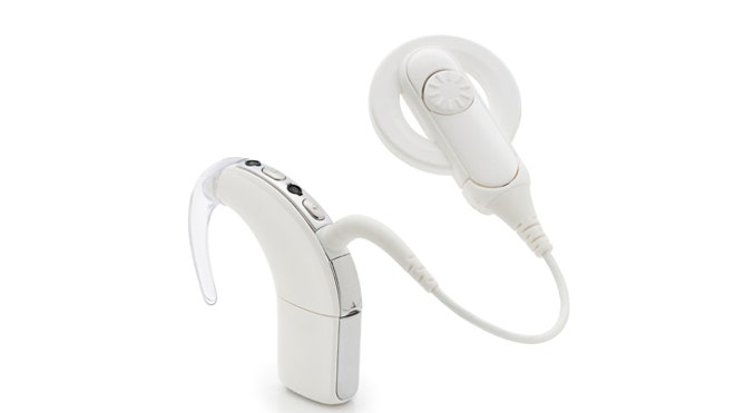 another_cochlear_implant.jpg