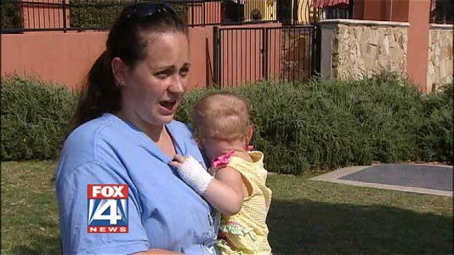 babywithburns.jpg